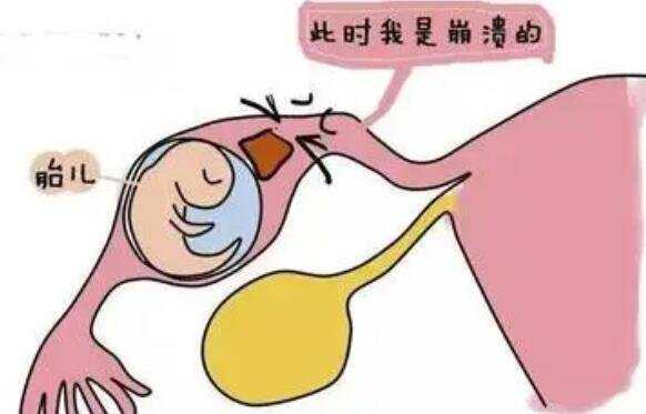 广州生殖中心助孕套餐 2022在广州试管医院做三代试管包生男孩贵不贵？附广州